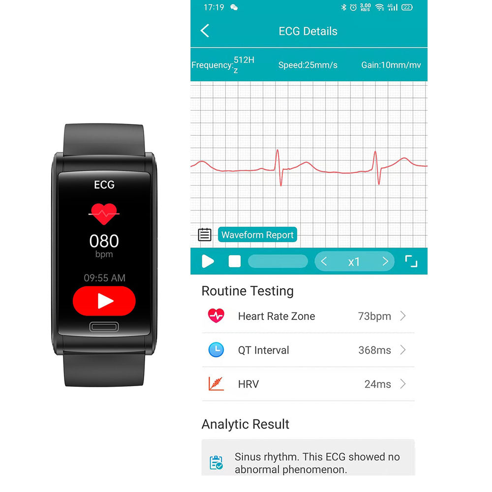 BCBEARSCOME BCE600 3-Lead ECG HRV Blood Glucose Blood Pressure Blood Oxygen Sleep Detection HD Bluetooth Smart Bracelet